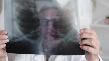 Göğüs taraması. Röntgen incelemesi. Teşhis radyolojisi. Göğüs kemikleri. Gözlüklü, kendinden emin orta yaşlı erkek doktor modern iç mekanda kaburga filmleri okuyor..