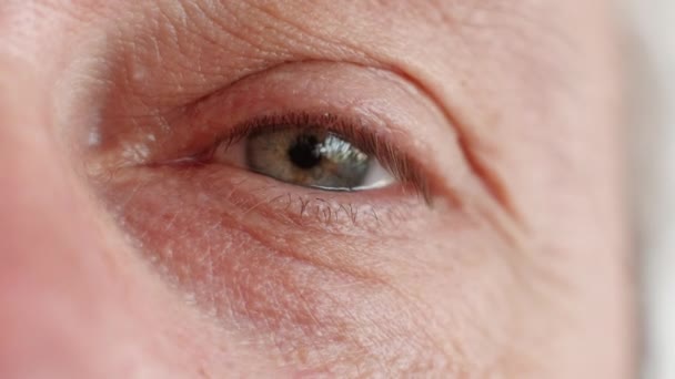 眼科护理视力矫正 眼科治疗 疲倦而忧郁的老年人面容憔悴 眼皮灰白色虹膜 — 图库视频影像
