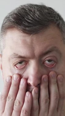 Sabah akşamdan kalmayım. Yorgun adam. Uykulu surat. Soluk soluğa kötü kokan gözleri kontrol eden sakat adam arka planda yüze dokunuyor. Dikey video.