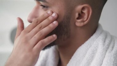 Sivilce tedavisi. Yüz derisi. Sorunlu cilt nemlendirici. Dermatoloji kozmetik ürünü. Sakallı adam kuru ve tahriş olmuş yüzüne serum sürüyor..