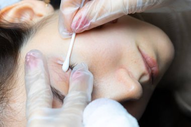 Pamuklu çubuklar kirpiklerdeki fazlalık pigmentleri temizler ve...