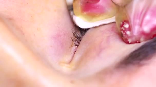 Essuyer l'excès de pigments de la paupière du modèle après un maquillage permanent. — Video