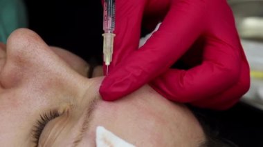 Botulinum toksini güzelliği hazırlar. Doktor, yüzün mecazi kısmına enjeksiyon yapar.