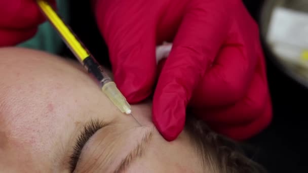ボツリヌス毒素製剤注射は 年齢関連のしわを滑らかにするために顔の眉毛や目の領域に美容注射を行います — ストック動画