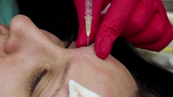 Botulinumtoxin Präparate Schönheit Injektion Arzt Injektionen Den Figurativen Teil Des — Stockvideo