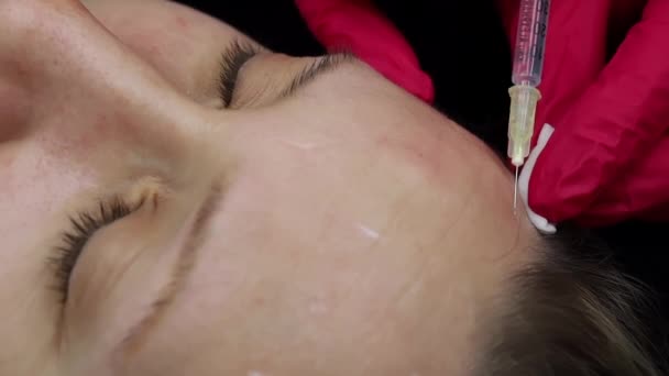 Préparations Toxines Botuliniques Injections Beauté Dans Partie Frontale Visage — Video