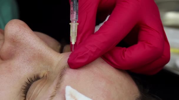 肉毒毒素制剂美容注射医生向面部的形体部位注射药物 — 图库视频影像