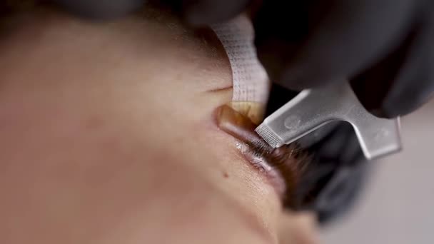 纤毛在小梳子的辅助下在纤毛上注入层压胶复合物的眼过程中的层压法 — 图库视频影像