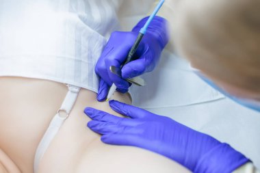electrolysis master working with a model in the armpit area removing unwanted hairs using an electrode and tweezers
