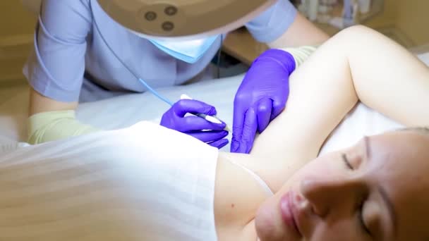 Doctor Electrolysis Removal Unwanted Hair Bows Model Removes Hair Armpits — Video