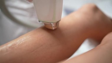 Bacaklardaki diyot lazer aldırma flaşını kapat. Kadının bacaklarında lazer tüy çıkarma prosedürü var. Yumuşak cilt için saç kesimi. Güzellik stüdyosunda lazer prosedürü ya da klinik kamera görüntüleri.