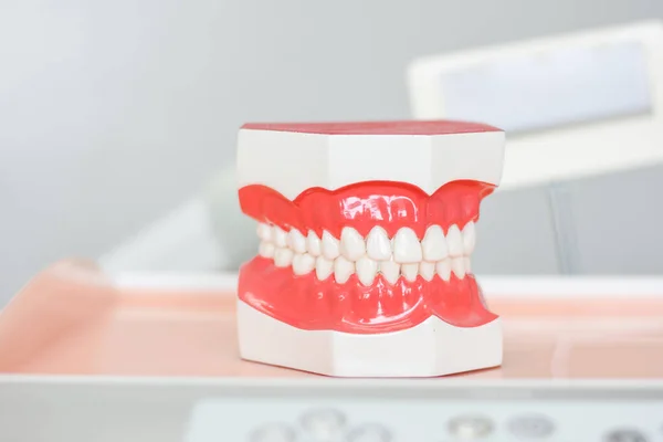 Dentalmodell Ett Sjukhus Som Ska Användas Som Ersättning För Kunder — Stockfoto