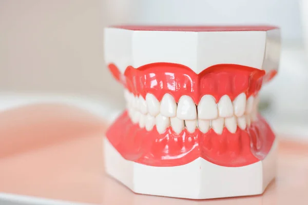 Dentalmodell Ett Sjukhus Som Ska Användas Som Ersättning För Kunder — Stockfoto