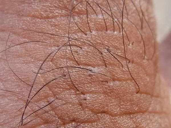 Closeup Wrinkled Skin Finger Hard Short Hair Growing Fingers — Stock Photo, Image