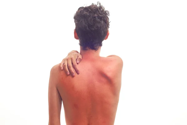 Damage Concept Back Skin Damaged Sun Rays —  Fotos de Stock