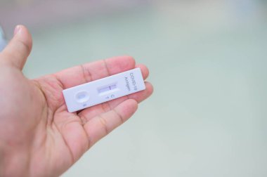 COVID-19 için insan eliyle yapılan testlerin sonuçları negatif.