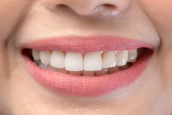 Tutup Gigi Putih Yang Sehat Indah Tersenyum Wanita Muda — Stok Foto