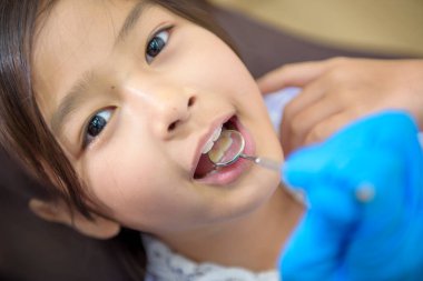Dişçi kliniğinde dişlerini kontrol ettiren küçük tatlı bir kız diş kontrolü ve sağlıklı diş konsepti.