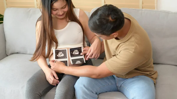 Young Pregnant Woman Husband Holding Ultrasound Photo Newborn Baby Maternity — Stock Photo, Image