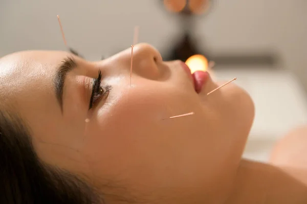 Beautiful Woman Received acupuncture treatment on face by  therapist, chinese medicine treatment, health and healing concept.