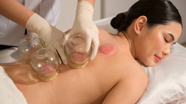 Mulher Bonita Recebido Cupping Tratamento Nas Costas Pelo Terapeuta Tratamento — Fotografia de Stock