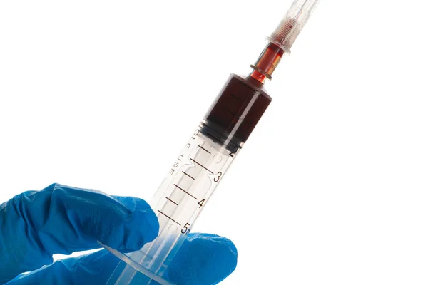 Primer plano de la prueba del tubo sanguíneo. Concepto de diagnóstico de Coronavirus 2019-ncov — Foto de Stock