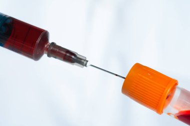 Mavi eldivenli doktor, elinde kan ve şırıngayla test tüpü tutuyor.
