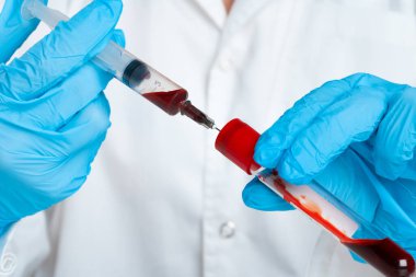 Mavi eldivenli doktor, elinde kan ve şırıngayla test tüpü tutuyor.