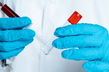 Mavi eldivenli doktor, elinde kan ve şırıngayla test tüpü tutuyor.