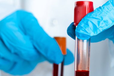Doktorlar mavi eldiven giyer, test tüpünü kanla doldururlar.