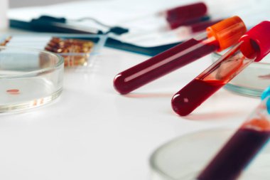 Tıbbi laboratuardaki bir masaya yerleştirilmiş test tüplerinin yakın çekimi.