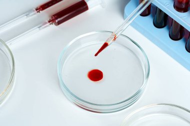 Cam düşürücü ve Petri kabı laboratuvar masasında.