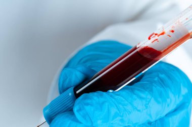 Mavi eldivenli doktor, elinde kan ve şırıngayla test tüpü tutuyor.