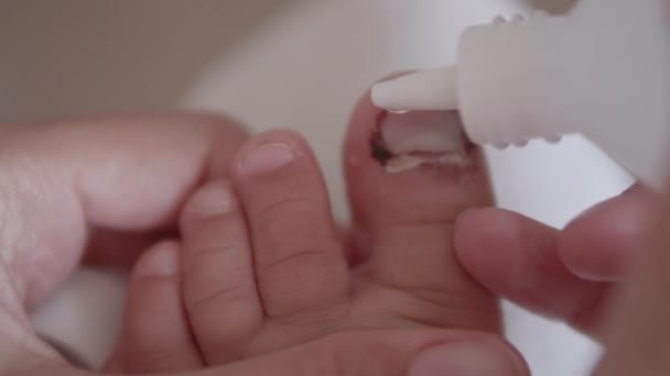 Mutter bindet ihren Kindern den großen Zeh. Nahaufnahme von Kinderfuß mit bandagiertem Finger. Erste Hilfe bei kleinen häuslichen Verletzungen. — Stockvideo