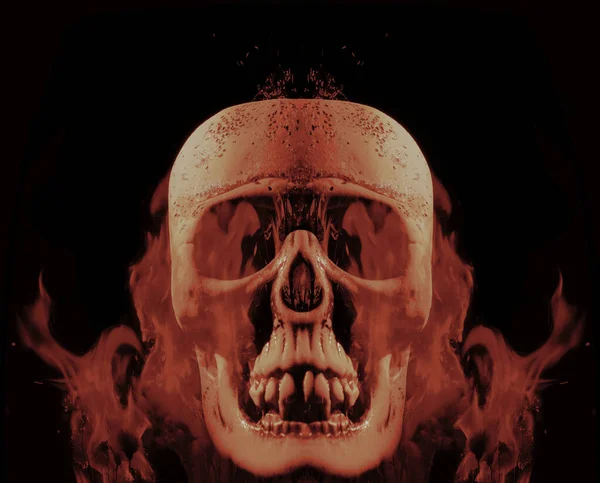 用火焰点燃人类的头骨 在黑色背景上隔离的照片图像 — 图库照片