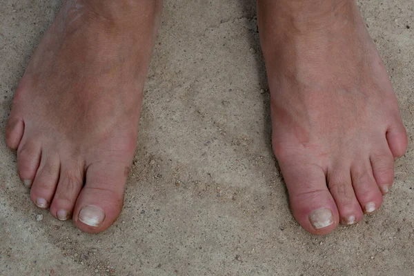 Gambe per adulti senza scarpe sul pavimento di cemento. — Foto Stock