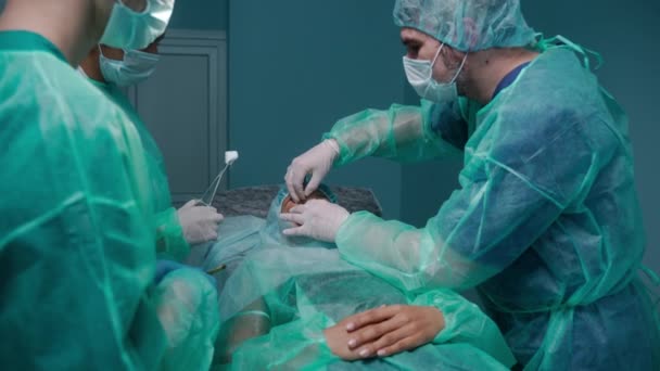 Три хирурга выполняют ринопластику в зеленых защитных платьях — стоковое видео