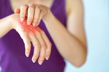 Alerji ya da böcek ısırığı yüzünden ellerinin kaşındığını hisseden kadınlar. Sağlık hizmeti kavramı.