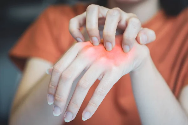 A woman\'s hand is scratching a red rash due to allergy symptoms.
