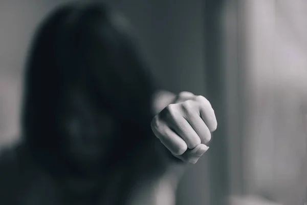 Mulher Tocando Joelho Devido Dor Joelho — Fotografia de Stock