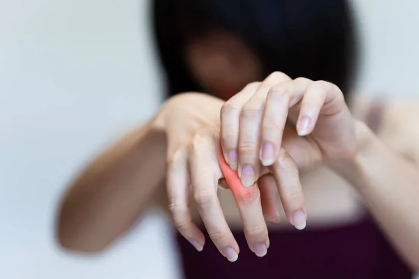 Woman Has Pain Her Knuckle Due Rheumatoid Arthritis — Stock Photo, Image