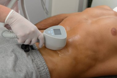 Erkeklerin göbeğinde lazer tüyü alınır. Doktor ve hasta klinikte..