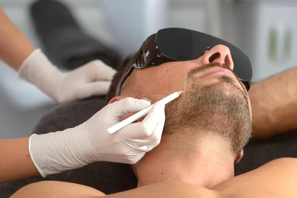 Erkeklerin yüzünde lazer tüyü alınır. Gözlüklü adam..