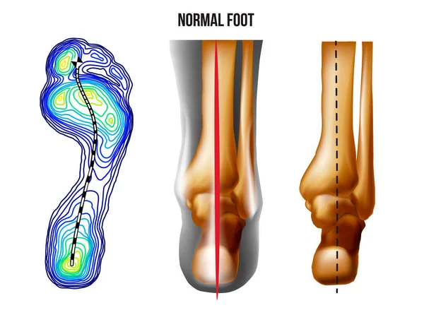 Fußgewichtsverteilung Knochen Realistischen Skelett Normalen Bogen Fußboden Und Rückansicht Keine lizenzfreie Stockvektoren