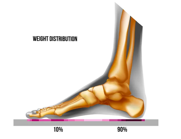 脚的重量分布 骨现实骨骼正常的足弓内侧的观点 没有变形 用于医疗矫形广告 矢量说明存量矢量 — 图库矢量图片