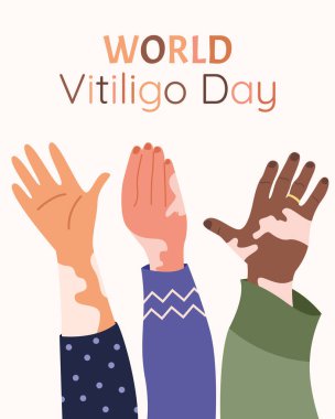 Ellerinde Vitiligo var. Düz vektör çizimi. Kartpostal, poster, Dünya Vitiligo Günü
