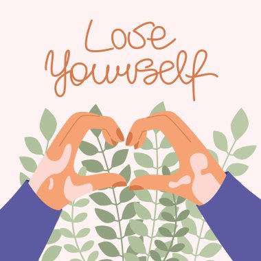 Ellerinde Vitiligo var. Düz vektör çizimi. Kartpostal, vücut pozitifliği, kendini kabullenme, kendini sev.