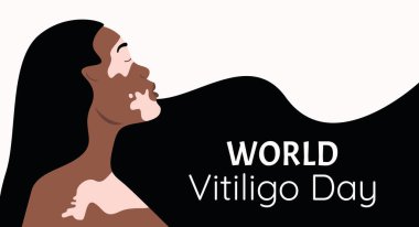 Kızın yüzünde Vitiligo var. Kartpostal, poster, Dünya Vitiligo Günü