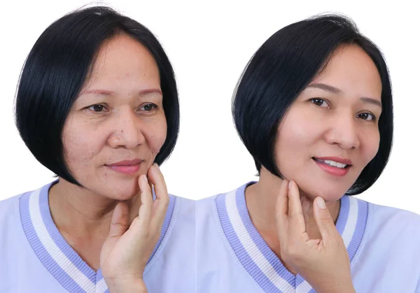 Азиатская Женщина Среднего Возраста После Ретуши Концепция Макияжа Пластической Хирургии — стоковое фото