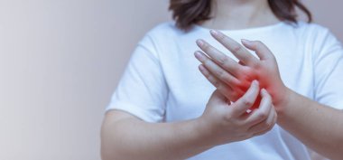 Ellerindeki kaşıntıyı kaşıyan kadın böcek ısırıklarına, dermatite, yiyeceğe ve uyuşturucuya karşı alerjik reaksiyon gösteriyor. Sağlık hizmeti kavramı.